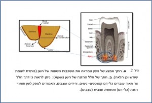 סוכרת ובעיות שיניים