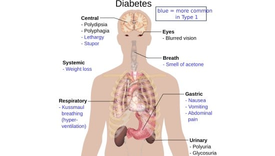 הסוכרת משפיעה על כלל מערכות הגוף. איור: pixabay