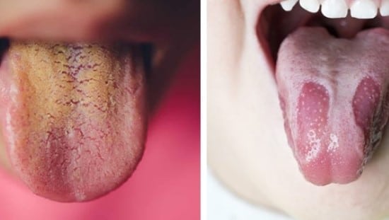 אבחון לשון. צילום באדיבות מועדון המטפלים הישראלי