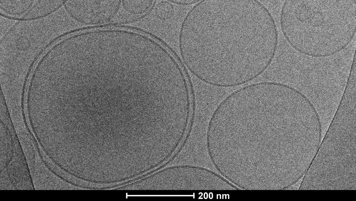 כך זה נראה מבעד למיקרוסקופ. תמונה: The 123